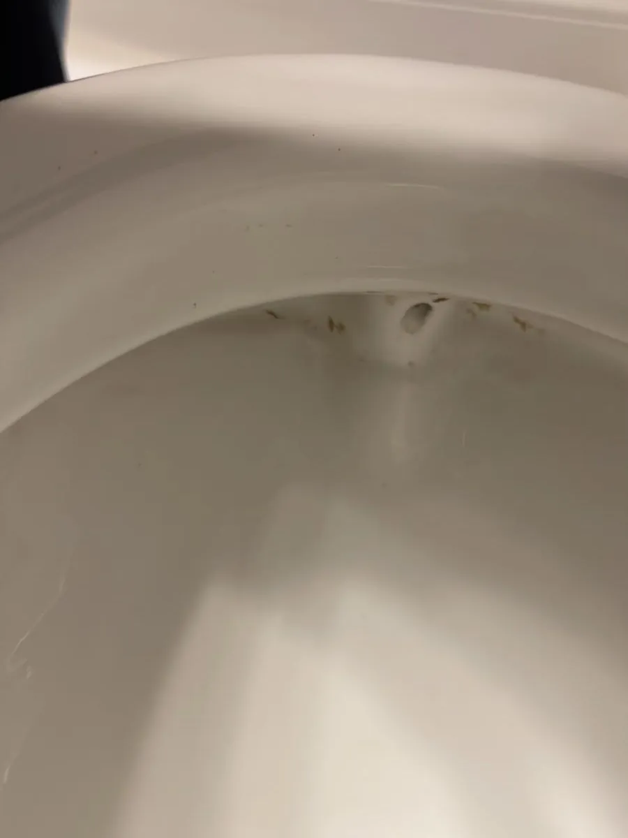 Toilet bowl rim after a deep cleaning in Clinton, MA — spotless porcelain