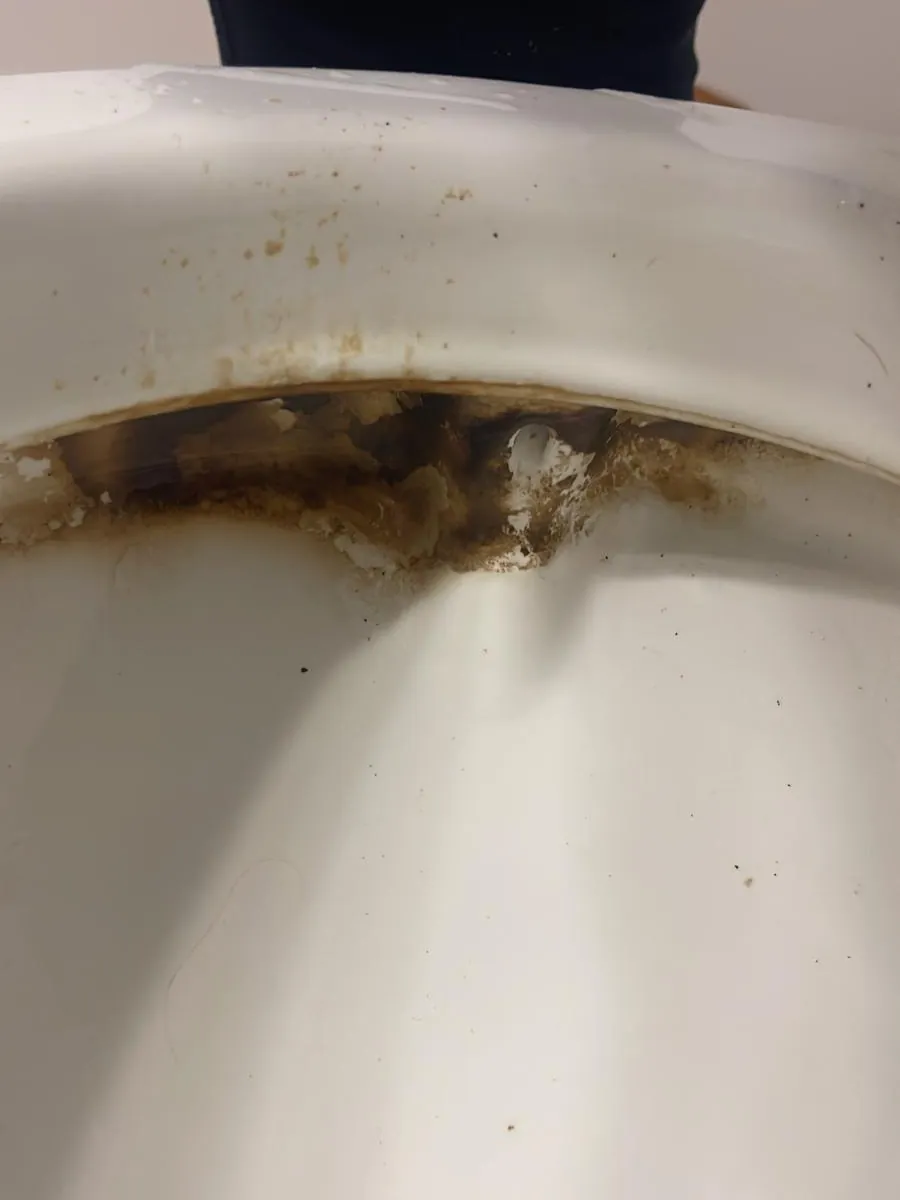 Toilet bowl rim before deep cleaning in Clinton, MA, with heavy brown mineral staining